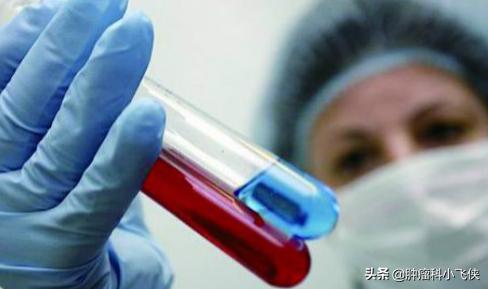 癌症治疗中如果出现这些迹象，恭喜你，说明癌症在好转！